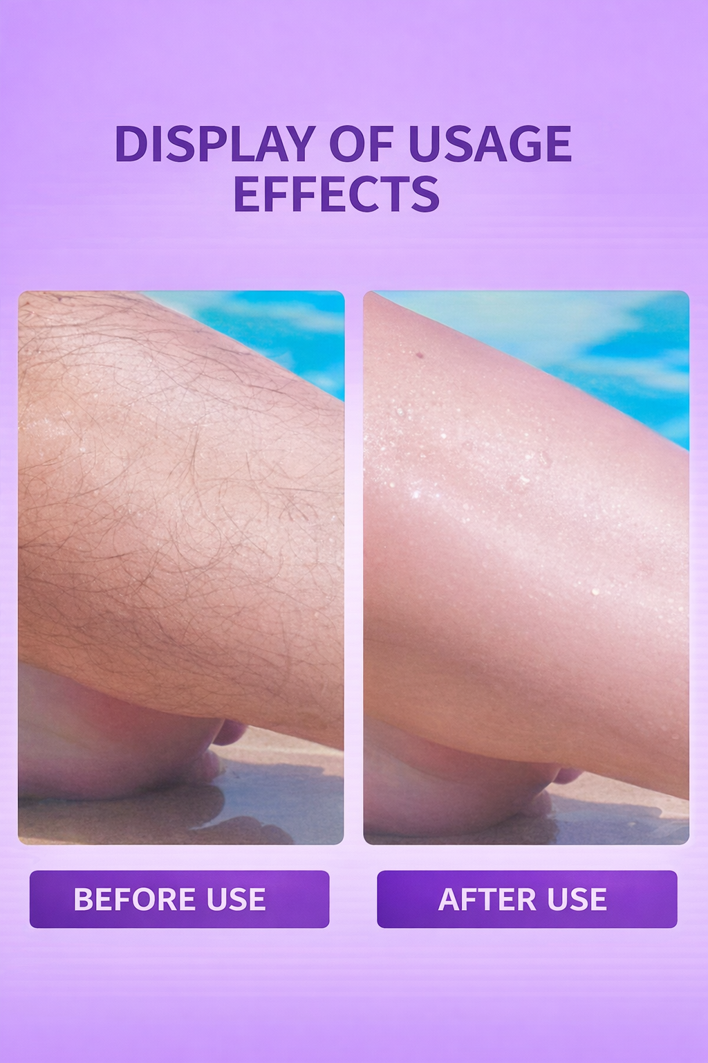 Radiva Epilator (Hair Removal Tool)